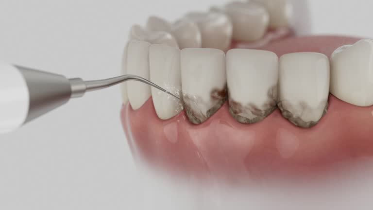 Reliable Emergency Dentist contractor in Lyford, TX by Smile Center Dentistry